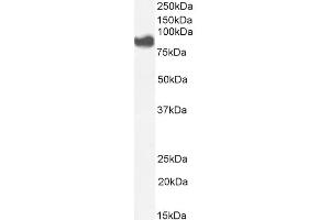 ABIN571180 (1µg/ml) staining of A549 cell lysate (35µg protein in RIPA buffer). (PLA2G4A Antikörper  (Internal Region))