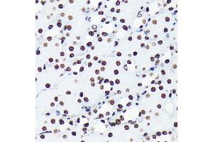 Immunohistochemistry of paraffin-embedded mouse kidney using Acetyl-Histone H4-K5 antibody (ABIN7267743) at dilution of 1:100 (40x lens). (Histone H4 Antikörper  (acLys5))