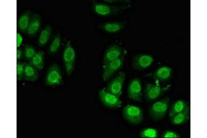 Immunofluorescent analysis of A549 cells using ABIN7142772 at dilution of 1:100 and Alexa Fluor 488-congugated AffiniPure Goat Anti-Rabbit IgG(H+L) (RPL23A Antikörper  (AA 1-92))