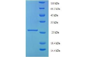 SDS-PAGE (SDS) image for Centrosomal Protein 126 (CEP126) (AA 559-670), (partial) protein (His-SUMO Tag) (ABIN5714476) (CEP126 Protein (AA 559-670, partial) (His-SUMO Tag))