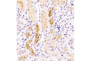 Immunohistochemistry of paraffin embedded mouse kidney using ASBT (ABIN7075648) at dilution of 1:1500 (400x lens) (SLC10A2 Antikörper)