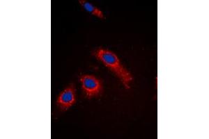 Immunofluorescent analysis of RPL3L staining in MCF7 cells. (RPL3L Antikörper  (Center))