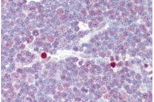 Anti-CREB1 / CREB antibody IHC staining of human thymus. (CREB1 Antikörper  (AA 91-140))