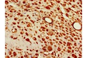 Immunohistochemistry of paraffin-embedded human placenta tissue using ABIN7171322 at dilution of 1:100 (T-Box 6 Antikörper  (AA 295-436))