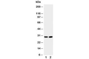 Western blot testing of Prion protein antibody and Lane 1:  rat brain (PRNP Antikörper  (Middle Region))
