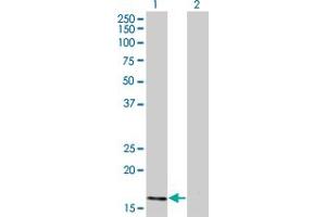 Western Blot analysis of ATOH7 expression in transfected 293T cell line by ATOH7 monoclonal antibody (M01), clone 1A5. (ATOH7 Antikörper  (AA 53-99))