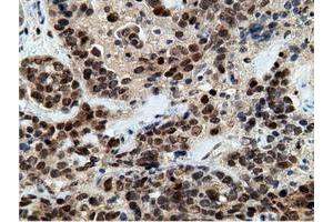Immunohistochemical staining of paraffin-embedded Human colon tissue using anti-EPM2AIP1 mouse monoclonal antibody. (EPM2AIP1 Antikörper)