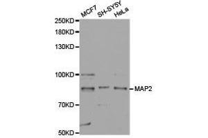 Western Blotting (WB) image for anti-Microtubule-Associated Protein 2 (MAP2) antibody (ABIN1873602) (MAP2 Antikörper)