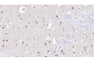 Immunohistochemistry (IHC) image for anti-Natriuretic Peptides B (NPPB) (AA 27-134) antibody (ABIN7445450)