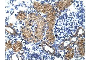 GTF3C5 antibody was used for immunohistochemistry at a concentration of 4-8 ug/ml to stain EpitheliaI cells of renal tubule (arrows) in Human Kidney.