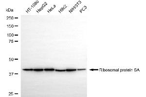 anti-Ribosomal Protein SA (RPSA) antibody