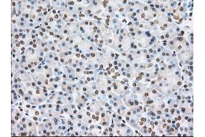 Immunohistochemical staining of paraffin-embedded Adenocarcinoma of Human colon tissue using anti-CYP1A2 mouse monoclonal antibody. (CYP1A2 Antikörper)