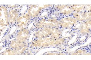 Detection of PADI2 in Human Kidney Tissue using Polyclonal Antibody to Peptidyl Arginine Deiminase Type II (PADI2)
