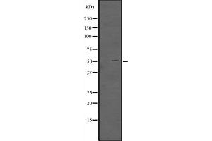 Western blot analysis of TFAP2D expression in TFAP2D transfected 293T cell lysate,The lane on the left is treated with the antigen-specific peptide. (TFAP2D Antikörper  (Internal Region))