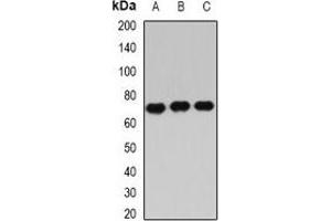 Western blot analysis of IGF2BP3 expression in Hela (A), PC3 (B), NIH3T3 (C) whole cell lysates.
