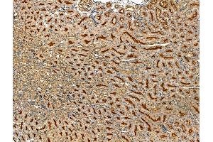 ABIN7094453 and ABIN7098501 at 1/100 staining Mouse kidney tissue by IHC-P.