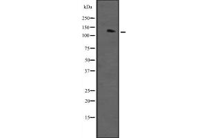 Western blot analysis of RASAL2 expression in Human plasma,The lane on the left is treated with the antigen-specific peptide. (RASAL2 Antikörper  (Internal Region))