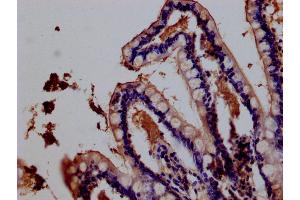 Immunohistochemistry of paraffin-embedded human testis tissue using ABIN7156606 at dilution of 1:100 (IL28RA Antikörper  (AA 21-228))