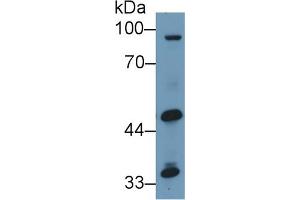 Western Blotting (WB) image for anti-Glutamic Pyruvate Transaminase (Alanine Aminotransferase) 2 (GPT2) (AA 210-300) antibody (ABIN7435643)