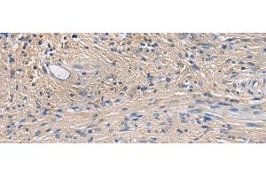 Immunohistochemistry of paraffin-embedded Human brain tissue using PA2G4 Polyclonal Antibody at dilution of 1:60(x200) (PA2G4 Antikörper)