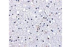 Immunohistochemistry (IHC) image for anti-Duffy Blood Group, Chemokine Receptor (DARC) (N-Term) antibody (ABIN1031343) (DARC Antikörper  (N-Term))