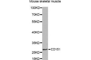 Western blot analysis of extracts of mouse skeletal muscle, using CD151 Antibody. (CD151 Antikörper)
