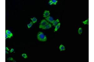 Immunofluorescence staining of HepG2 cells with ABIN7139763 at 1:50, counter-stained with DAPI. (CAPRIN2 Antikörper  (AA 83-100))