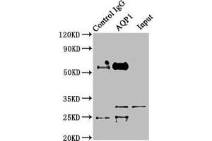 Immunoprecipitating AQP1 in Mouse skeletal muscle tissue Lane 1: Rabbit control IgG instead of ABIN7144499 in Mouse skeletal muscle tissue. (Aquaporin 1 Antikörper  (AA 220-269))