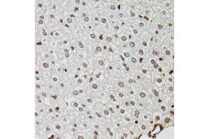 Immunohistochemistry of paraffin-embedded mouse liver using KDM4A antibody. (KDM4A Antikörper)