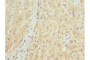 Immunohistochemistry of paraffin-embedded human liver tissue using ABIN7155892 at dilution of 1:100 (HGD Antikörper  (AA 226-445))