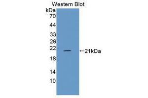 Western blot analysis of the recombinant protein. (FLG2 Antikörper  (AA 1222-1368))