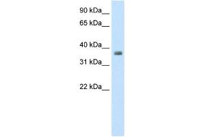 WB Suggested Anti-ZFP36 Antibody Titration:  0. (ZFP36 Antikörper  (N-Term))