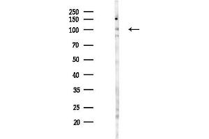 anti-Mitogen-Activated Protein Kinase Kinase Kinase 14 (MAP3K14) (pThr559) antibody