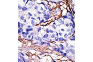 Image no. 2 for anti-RanBP-Type and C3HC4-Type Zinc Finger Containing 1 (RBCK1) (N-Term) antibody (ABIN357475)