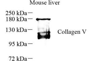 Western blot analysis of collagen alpha-1 (V) (ABIN7073547) at dilution of 1: 500 (Collagen Type V Antikörper)
