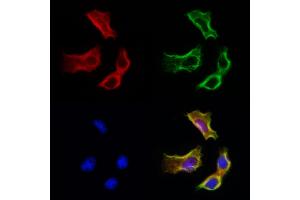 ABIN6265370 and ABIN6272981 staining Hela cells by IF/ICC. (SULT1E1 Antikörper  (Internal Region))