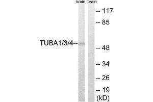 Western Blotting (WB) image for anti-TUBA1/3/4 (Tyr272) antibody (ABIN1848392) (TUBA1/3/4 (Tyr272) Antikörper)