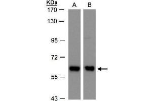 WB Image Sample(30 ug whole cell lysate) A:H1299 B:Hep G2, 7. (ARCN1 Antikörper)