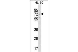 Western blot analysis in HL-60 cell line lysates (35ug/lane). (MBTD1 Antikörper  (C-Term))