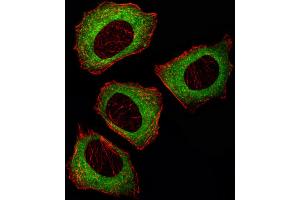 Fluorescent image of U251 cell stained with MEK2 (MAP2K2) Antibody .