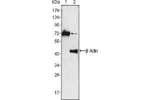 Western blot analysis using ZAP70 mouse mAb against Jurkat cell lysate (1). (ZAP70 Antikörper)