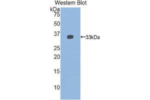 Western Blotting (WB) image for anti-Slow Skeletal Troponin T (TNNT1) (AA 1-261) antibody (ABIN1860820)