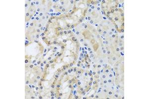 Immunohistochemistry of paraffin-embedded mouse kidney using CETN3 antibody (ABIN5974786) at dilution of 1/100 (40x lens). (CETN3 Antikörper)