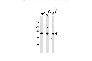 All lanes : Anti-LZIC Antibody (Center) at 1:2000 dilution Lane 1: Hela whole cell lysate Lane 2: K562 whole cell lysate Lane 3: PC-12 whole cell lysate Lysates/proteins at 20 μg per lane. (LZIC Antikörper  (AA 81-109))