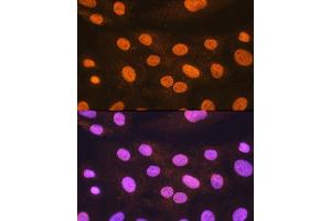 Immunofluorescence analysis of H9C2 cells using POLR2A Rabbit pAb (ABIN3022932, ABIN3022933, ABIN3022934 and ABIN6219303) at dilution of 1:100. (POLR2A/RPB1 Antikörper  (AA 1-260))