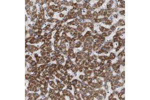 Immunohistochemical staining of human stomach with MARC2 polyclonal antibody  shows strong cytoplasmic positivity in glandular cells. (MARC2 Antikörper)