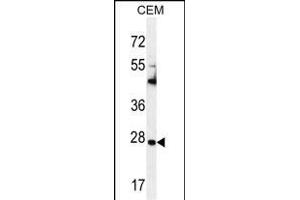 TIMP1 Antikörper  (C-Term)