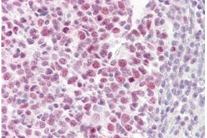 Anti-PIAS4 antibody IHC staining of human tonsil. (PIAS4 Antikörper  (AA 451-500))