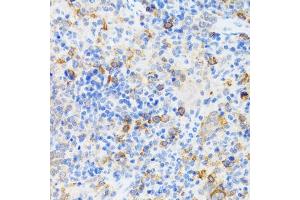 Immunohistochemistry (IHC) image for anti-Chromatin Assembly Factor 1, Subunit B (p60) (CHAF1B) (AA 270-559) antibody (ABIN6138482)