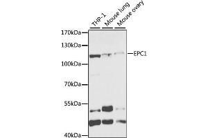 Western blot analysis of extracts of various cell lines, using EPC1 antibody (ABIN6133506, ABIN6140203, ABIN6140204 and ABIN6221494) at 1:1000 dilution. (EPC1 Antikörper  (AA 1-300))